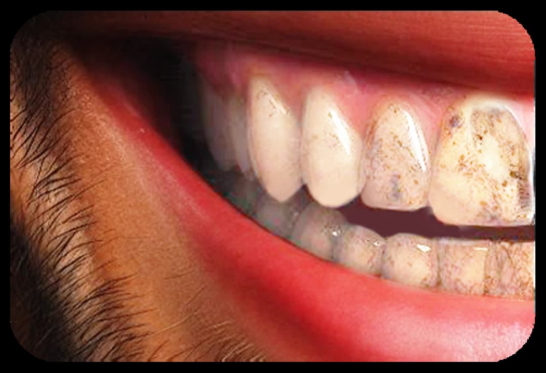 Before treatment